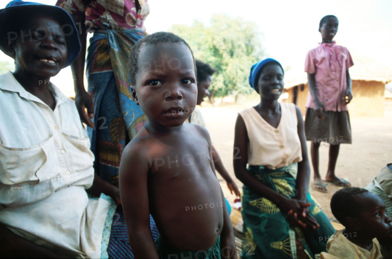 Third world child
