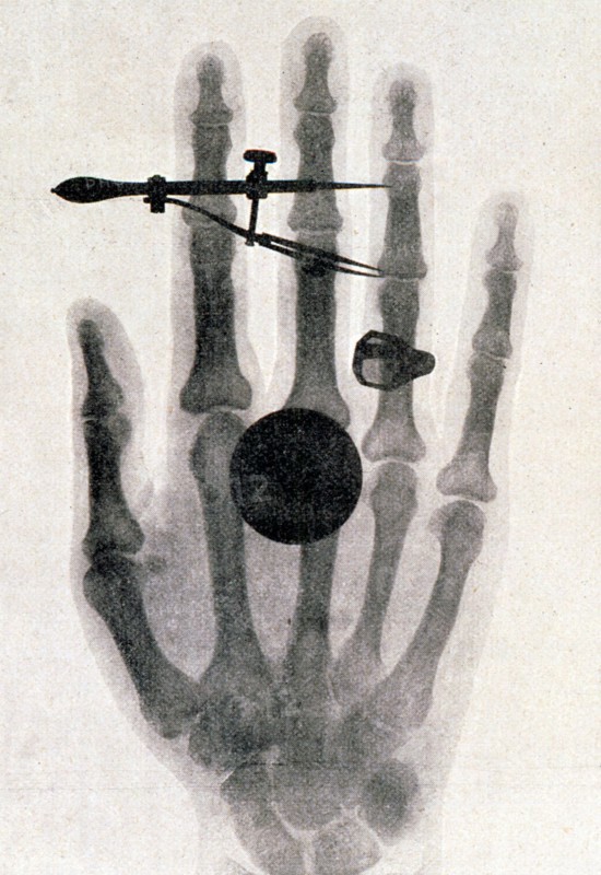 Wilhelm Roentgen's