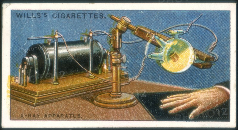 X-ray apparatus powered by a Ruhmkorff coil being used to take an X-ray of a hand