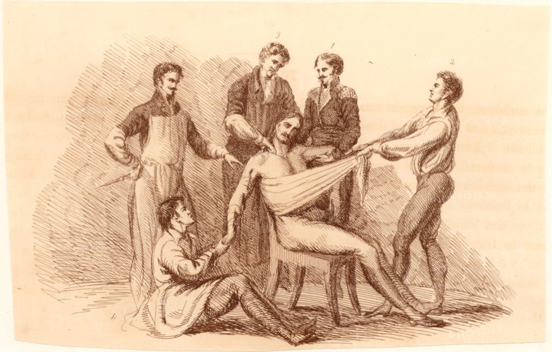 Surgeon and his assistants, before the introduction of anaesthetics