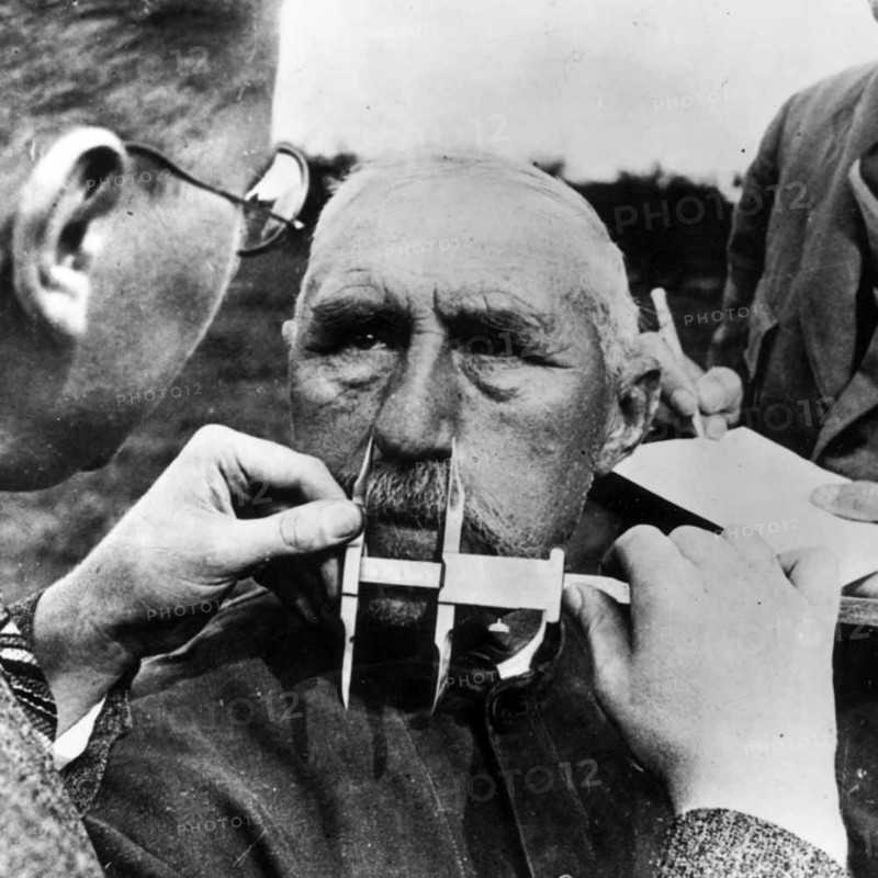 A man having his nose measured during Aryan race determination tests under Nazi Germany's Nuremberg Laws that was applied to determine whether a person was considered a 'Jew'