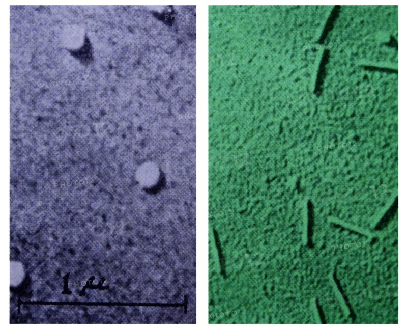 Influenza virus taken through a microscope
