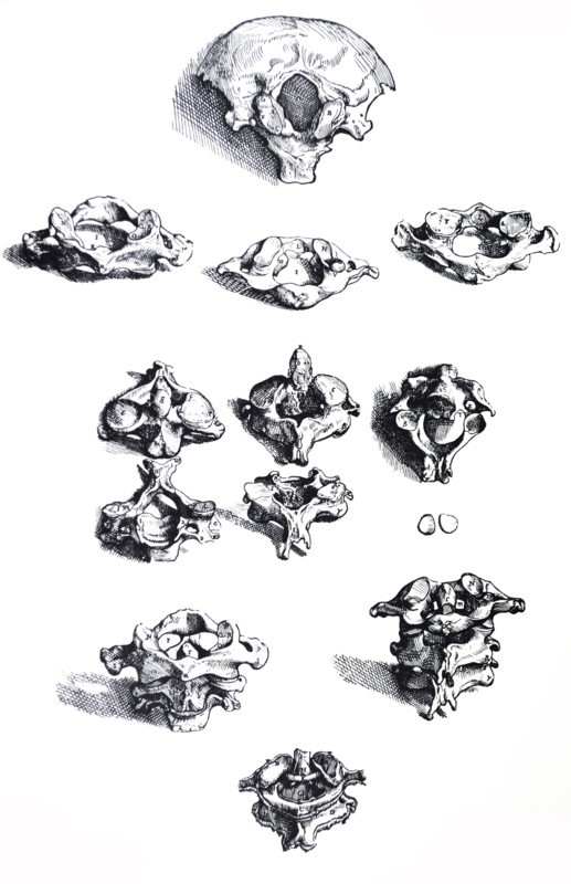 Plates from the First Book of the De Humani Corporis Fabrica by Vesalius