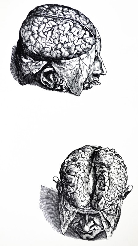Plates from the Seventh Book of the De Humani Corporis Fabrica by Vesalius
