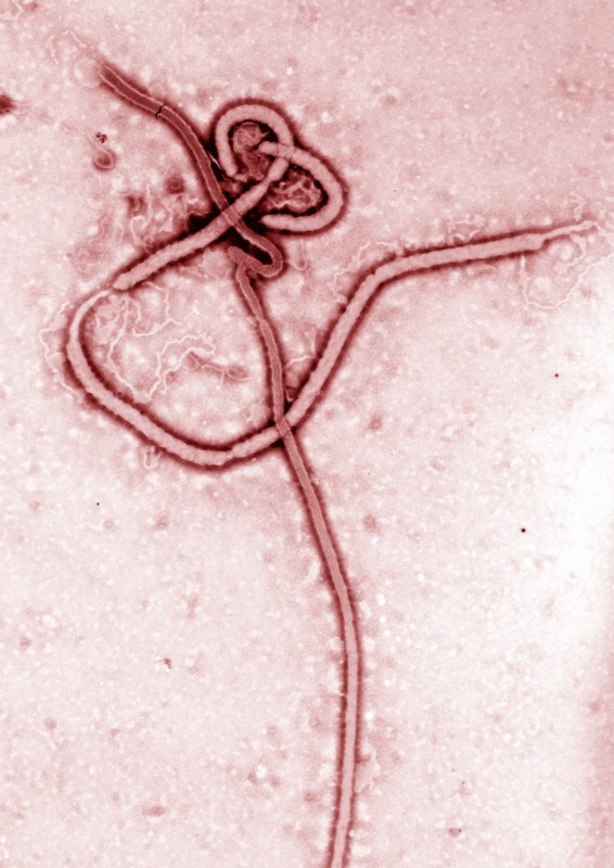 Transmission electron Micrograph of the Ebola Virus Hemorrhagic Fever RNA Virus