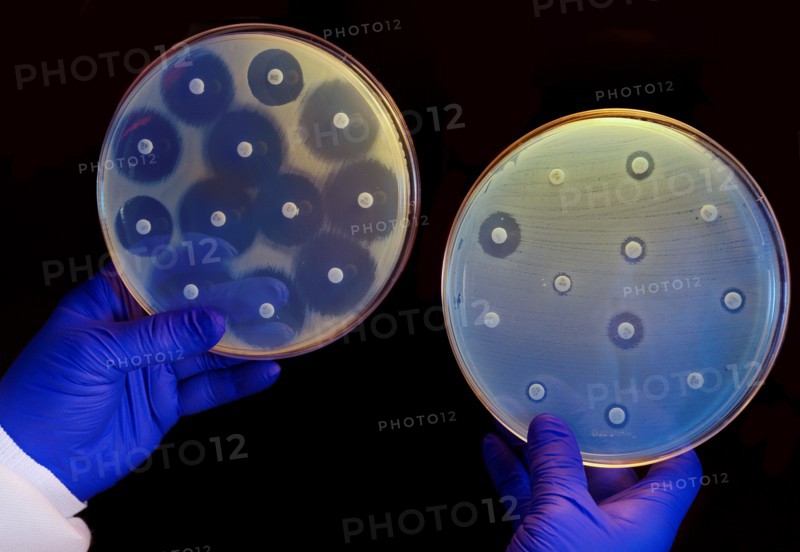 two plates growing bacteria in the presence of discs containing various antibiotics