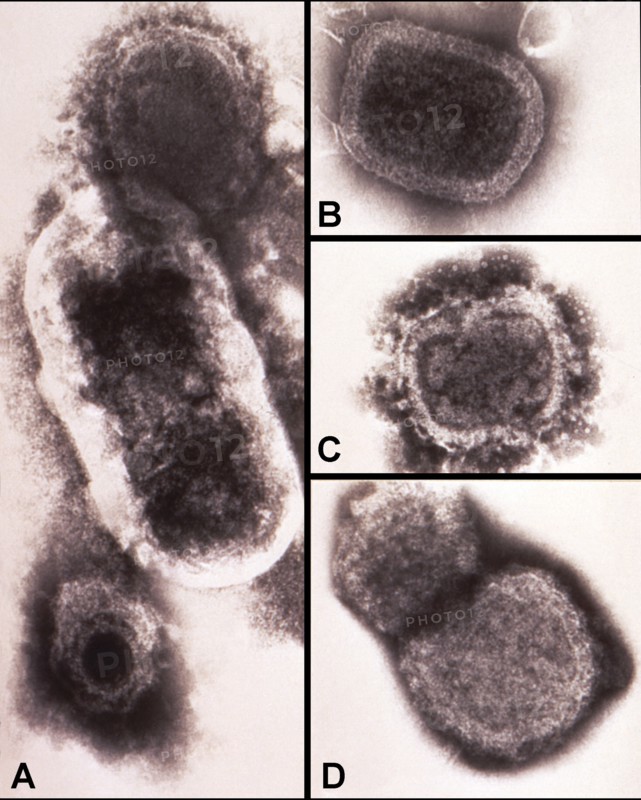 electron micrograph (TEM) revealing some of the ultrastructure morphology exhibited by a number of different microorganisms