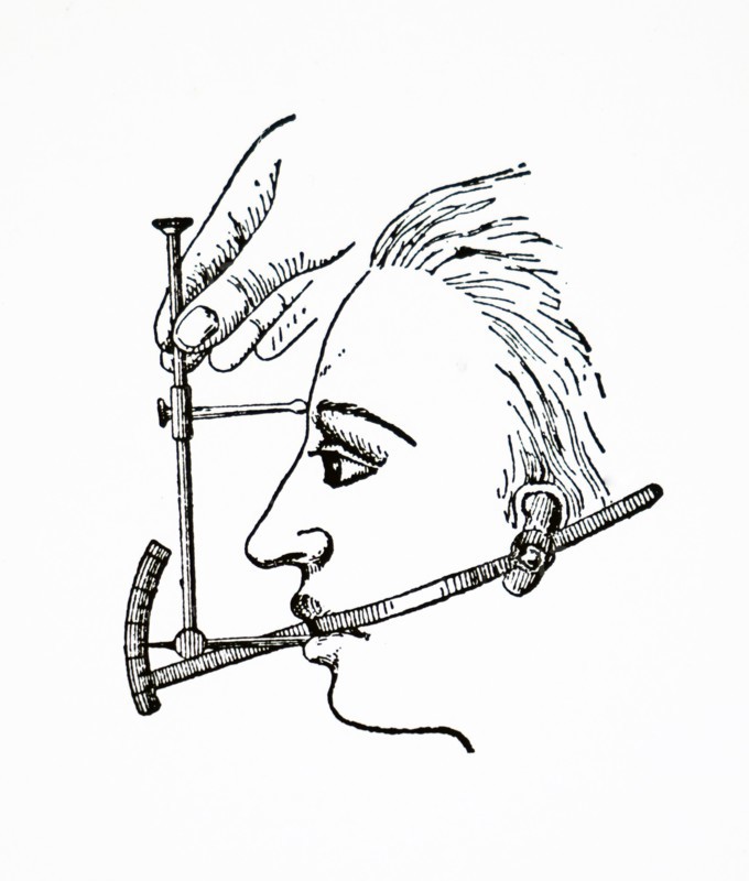 A clinometer used for measuring angles of the profile of a face