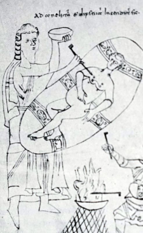 Illustration depicting a medieval surgical operation