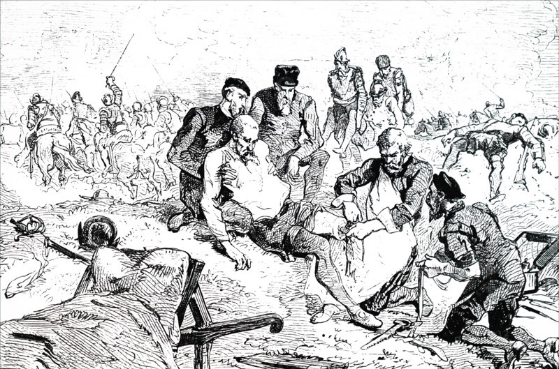 Ambroise Paré tying off arteries after amputation during the siege of Boulogne