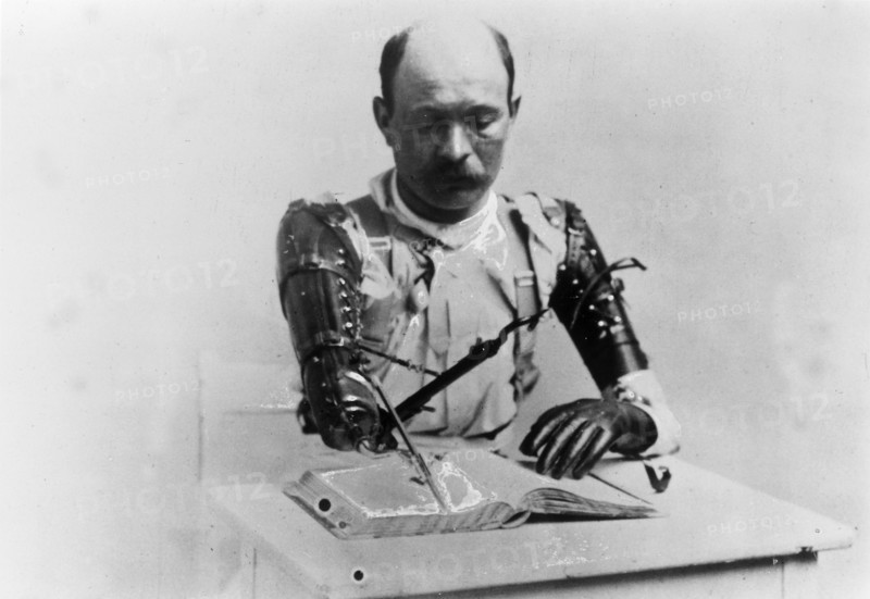 Soldat mutilé pendant la 1ère Guerre Mondiale