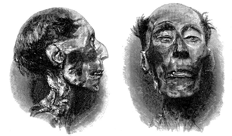 Mummy of Ramses II
