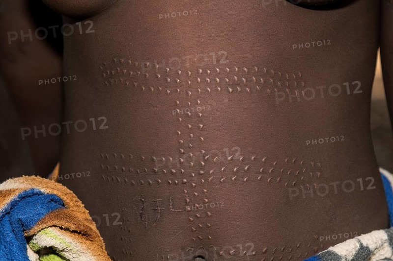 Young woman with ornamental scars on the belly