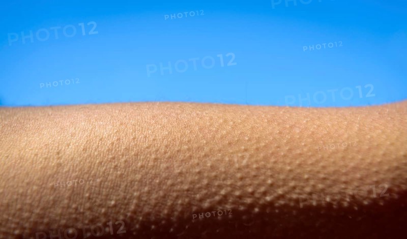 Goose bumps