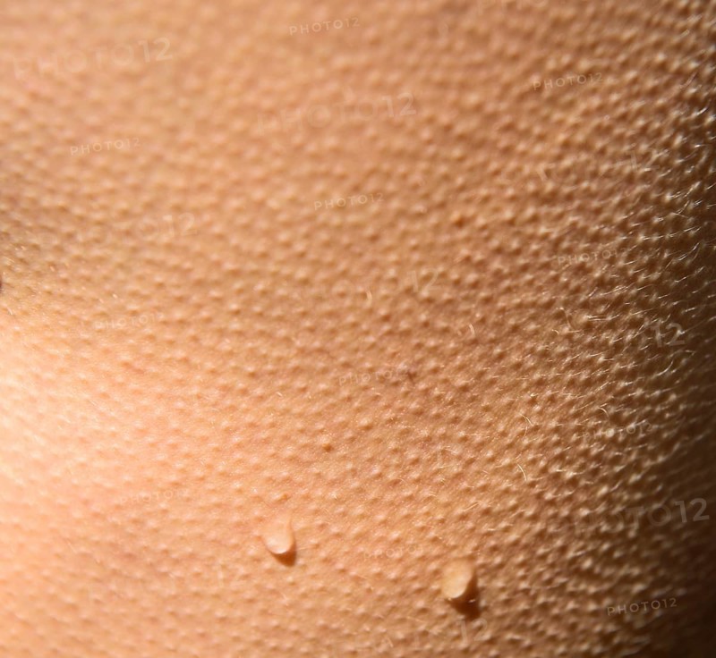 Goose bumps with drops of water