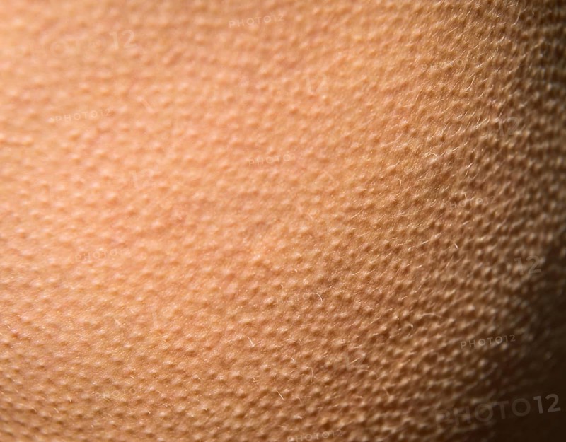 Goose bumps