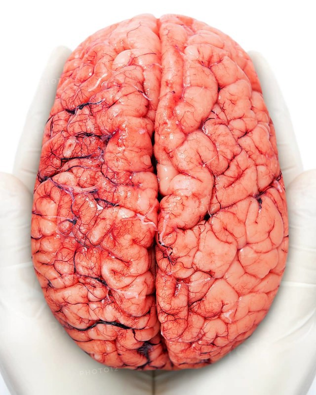 Human brain