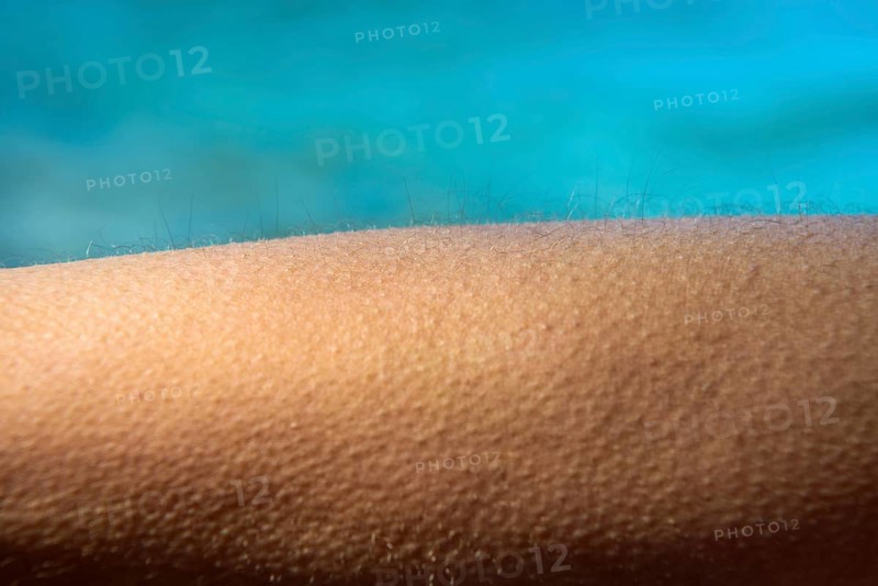 Goose bumps
