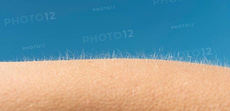 Goosebumps