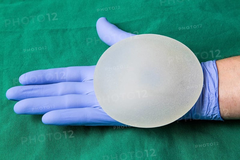 Silicone breast implant
