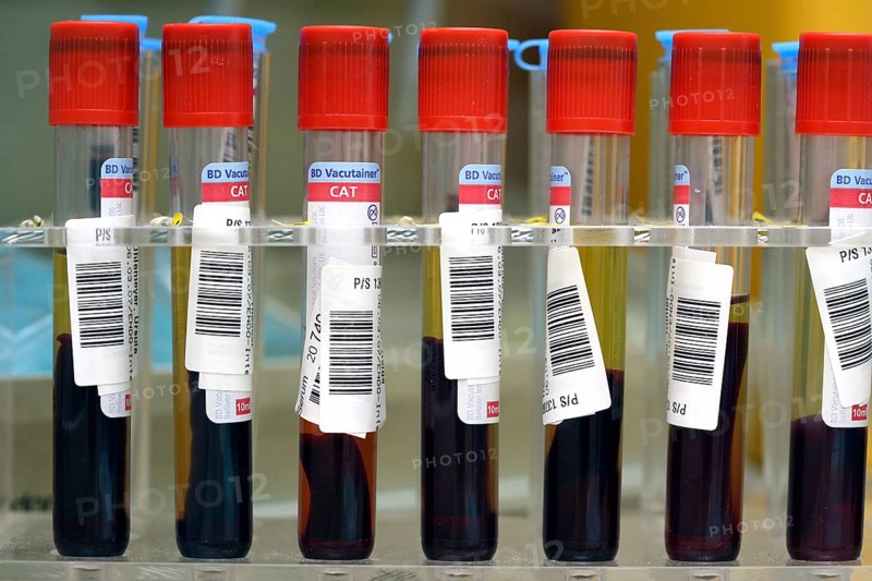 Blood samples in medical laboratory