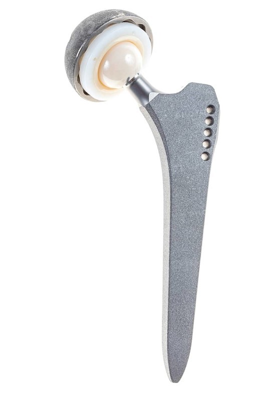 Endoprosthesis