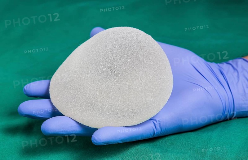 Silicone breast implant