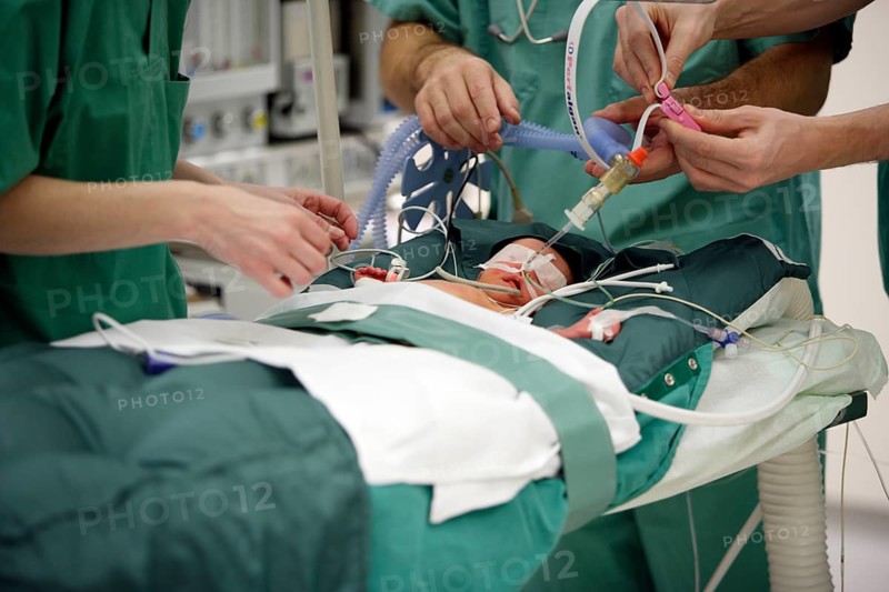 Surgery of a newborn