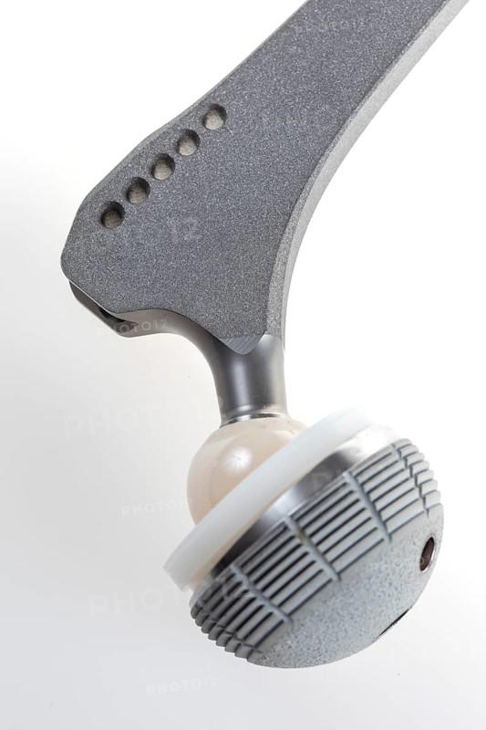 Endoprosthesis