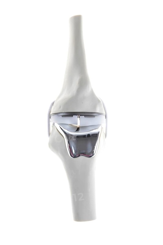 Knee prosthesis