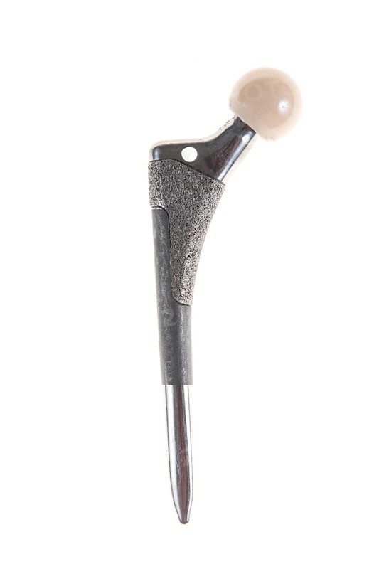 Endoprosthesis
