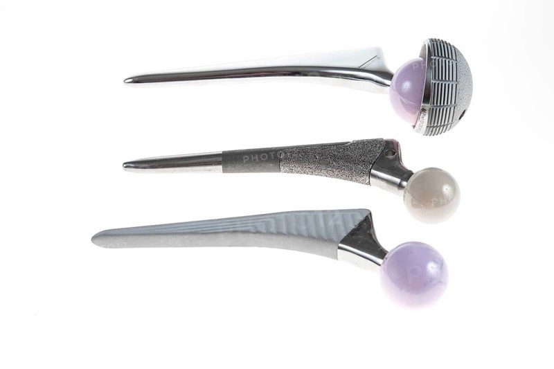 Endoprosthesis