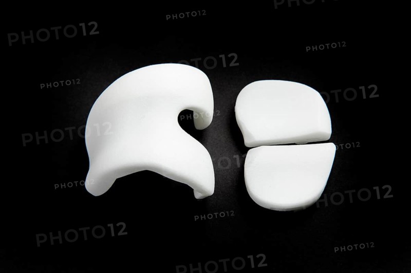 Knee prosthesis