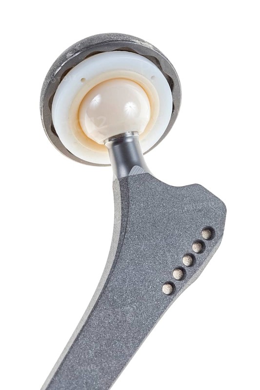Endoprosthesis