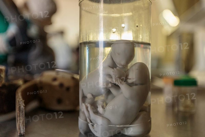 Preserved lion fetuses