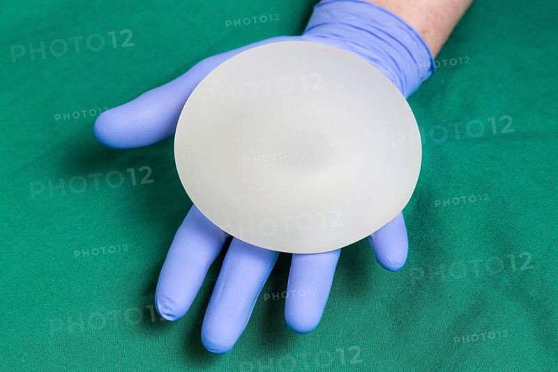 Silicone breast implant