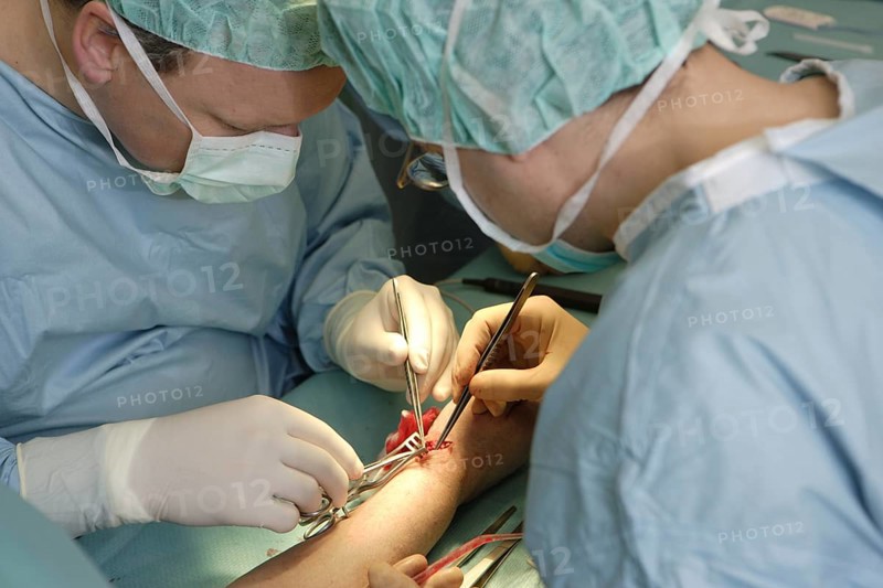 Vascular surgery