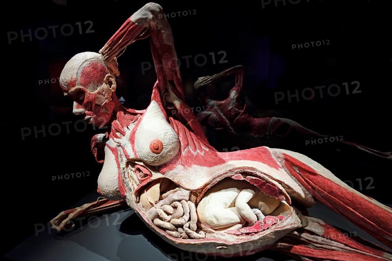 Plastinate