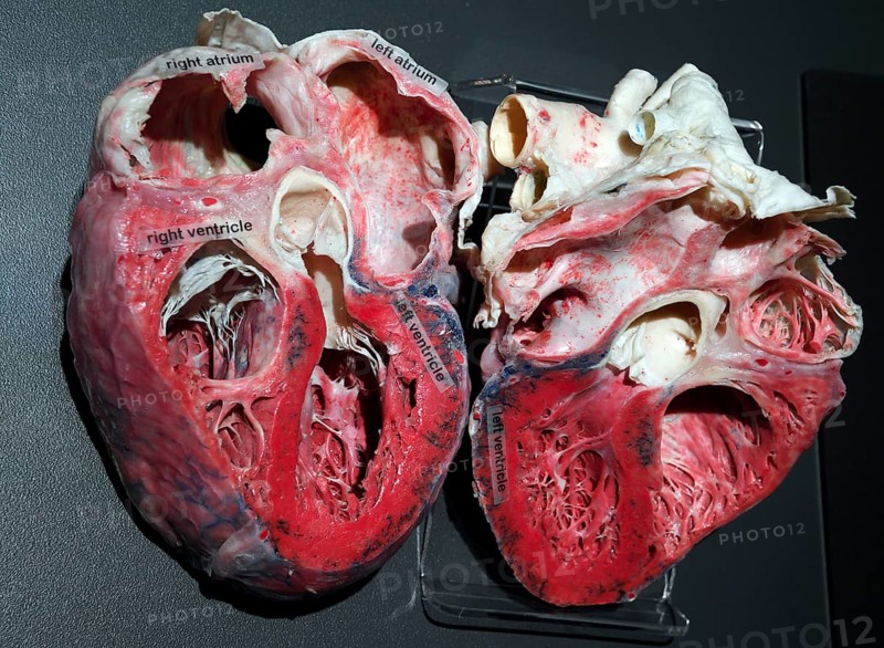 Plastinate