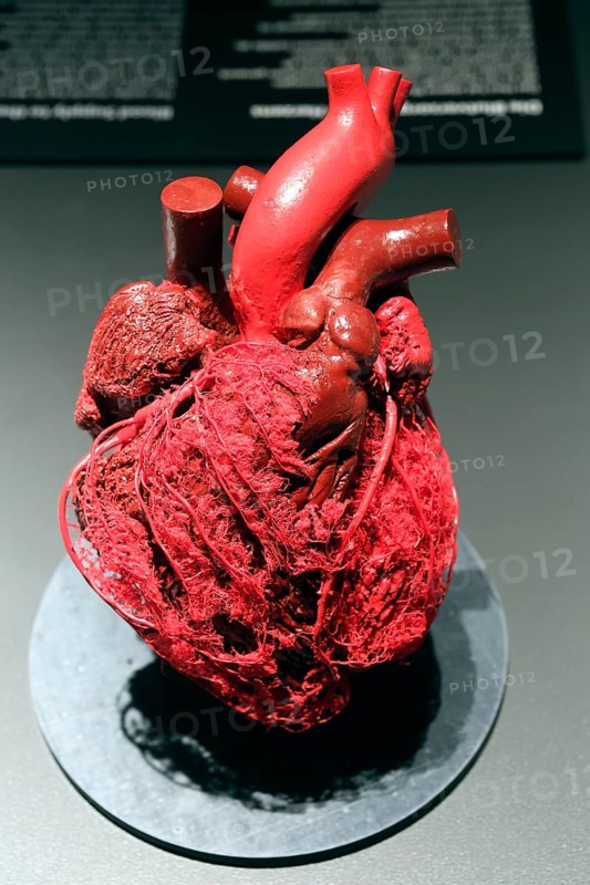 Plastinate