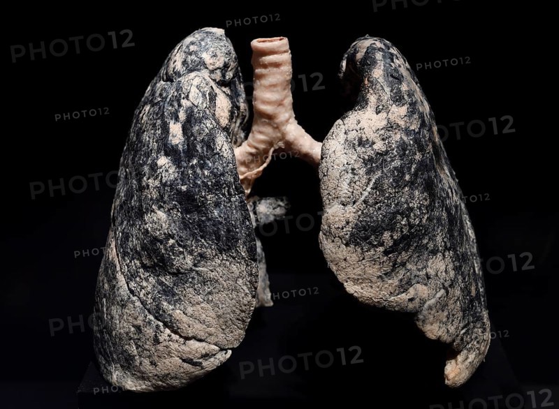 Plastinate