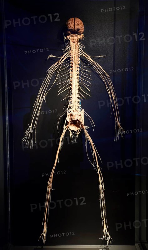 Plastinate