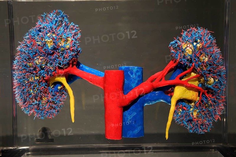 Plastinate