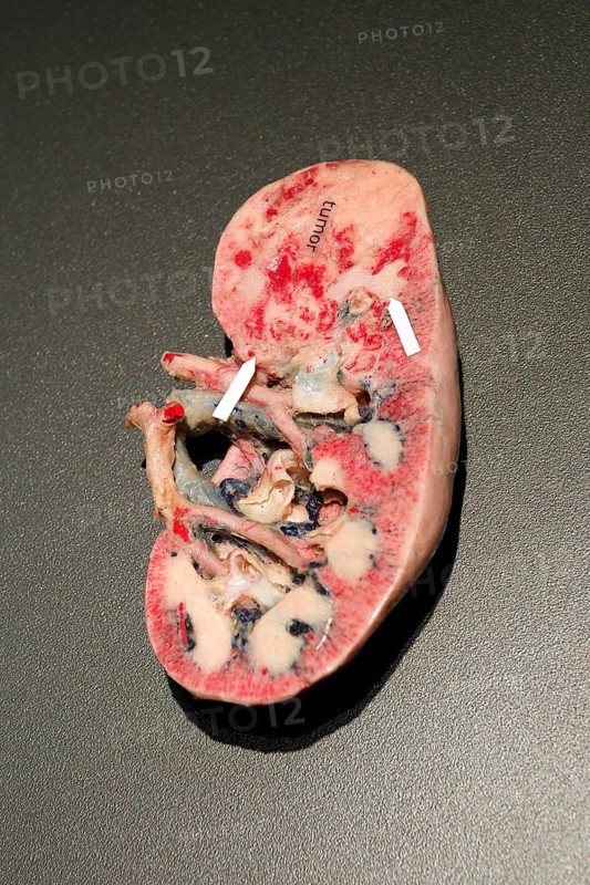 Plastinate
