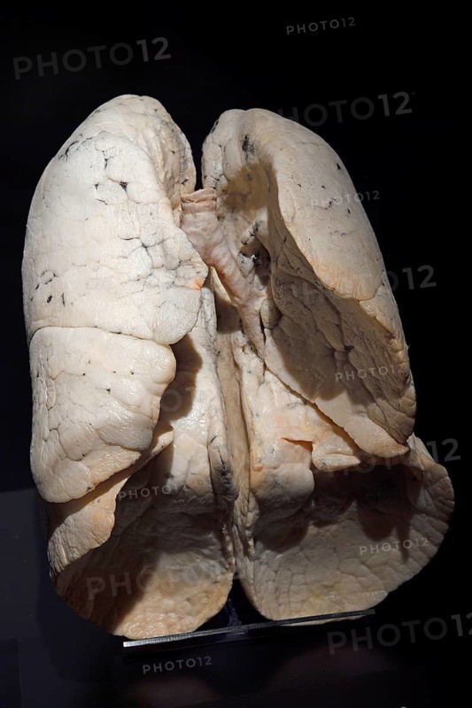 Plastinate
