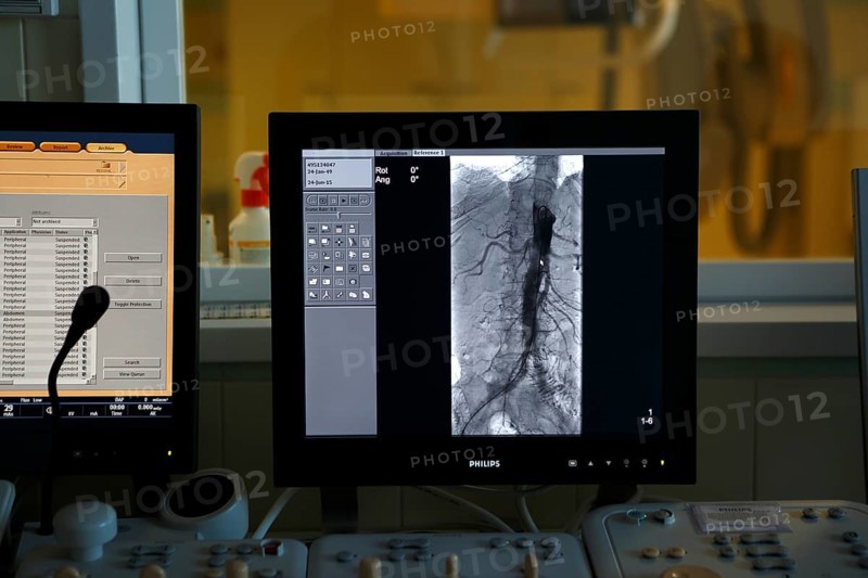 Interventional radiology