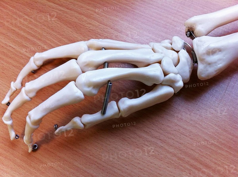 Artificial Hand