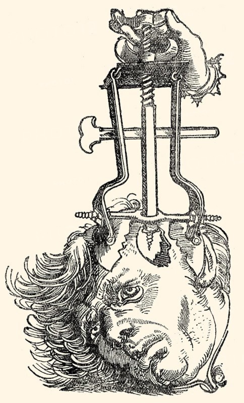 Skull surgery