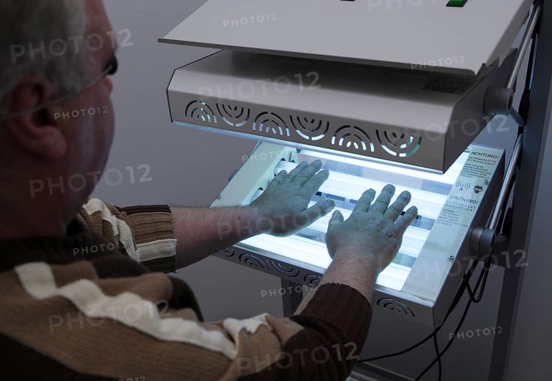 Patient has his hands in a phototherapy box for an irradiation treatment