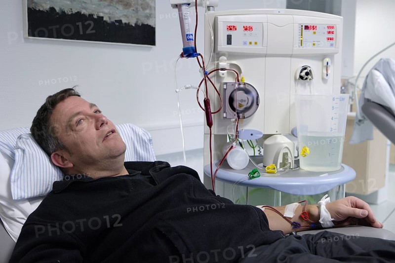 Patient during outpatient dialysis in the dialysis center of the Dominikus Krankenhaus hospital
